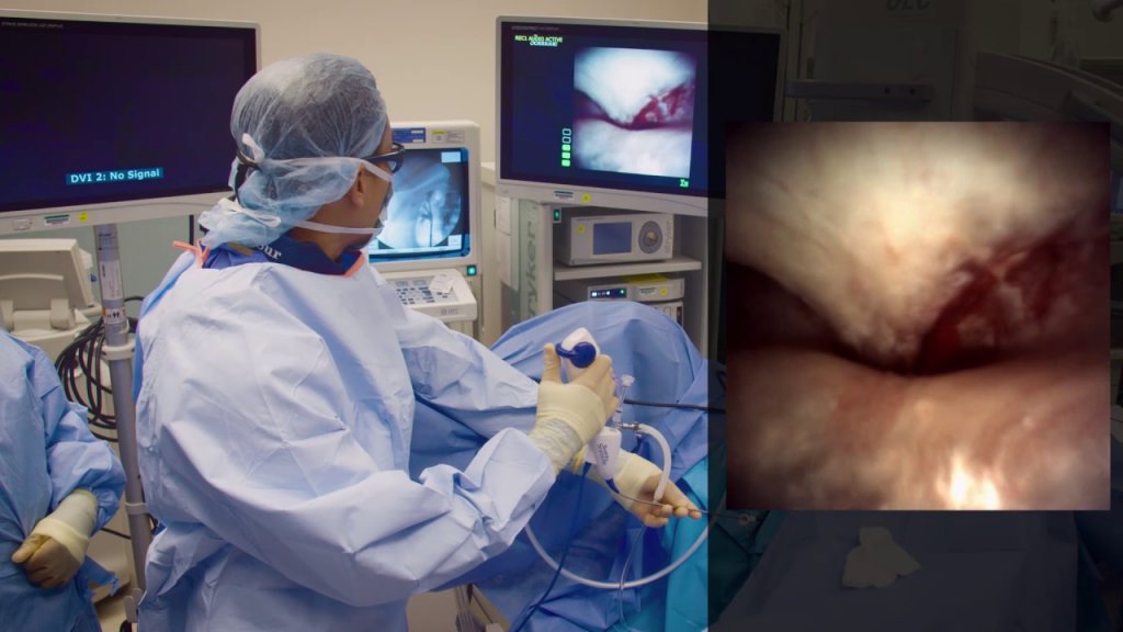 Flexible Ureteroscopy  Large Stone Procedure